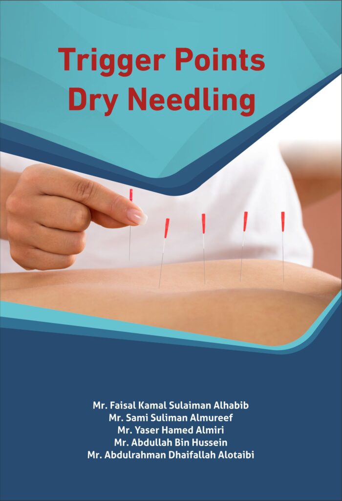 TRIGGER POINTS DRY NEEDLING - Horizon Books